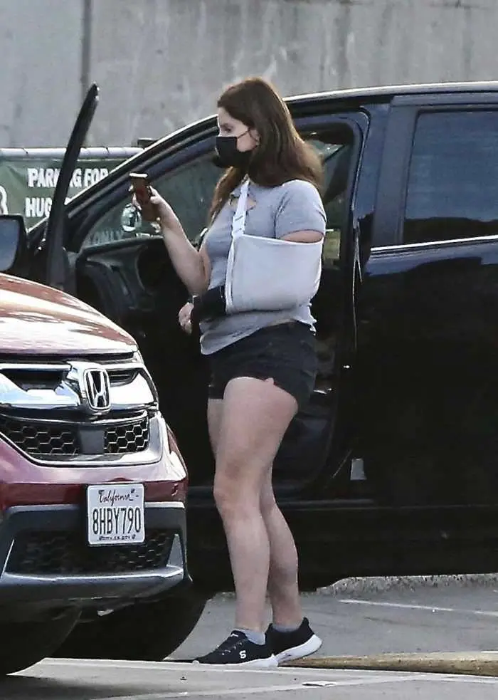 lana del rey goes out without her engagement ring and reveals how she fractured her arm 2