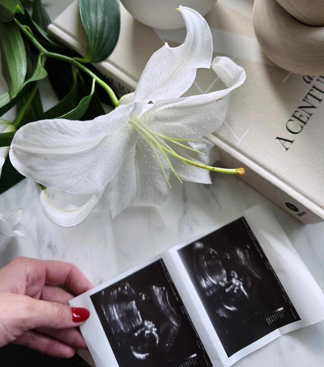 Baby Duhamel on the Way! Josh Duhamel and Audra Mari Expecting First Child